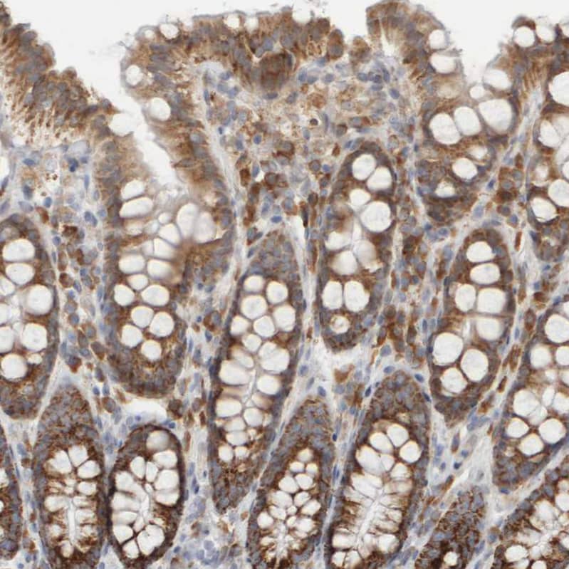 Immunohistochemistry-Paraffin Ribophorin II Antibody - BSA Free