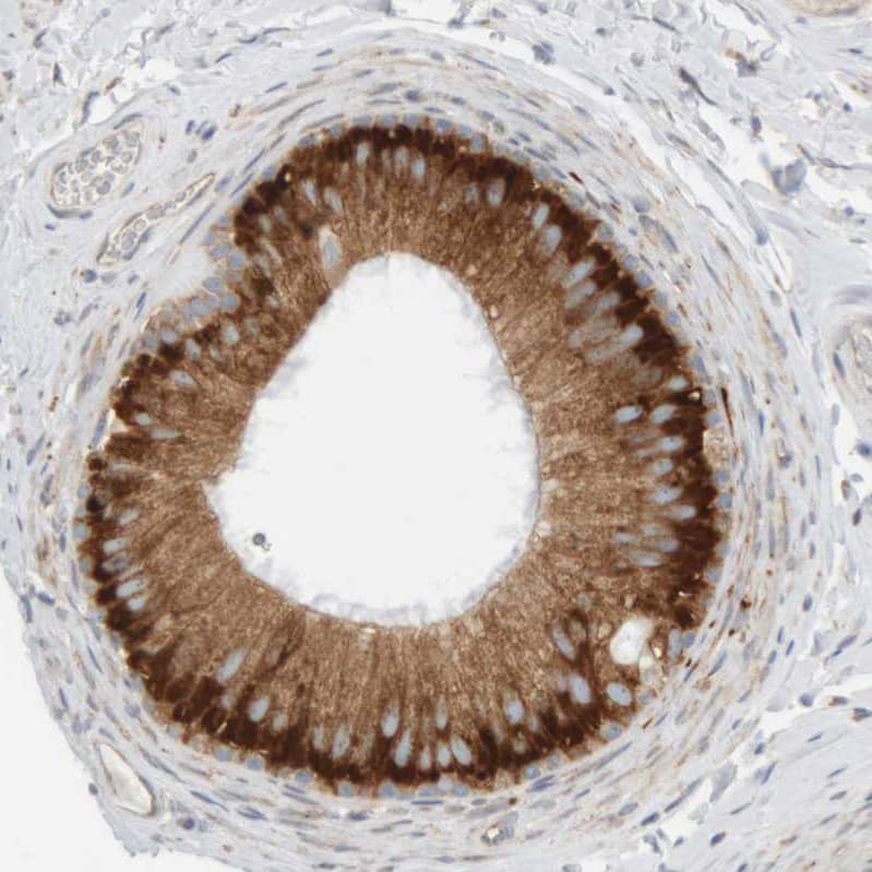 Immunohistochemistry-Paraffin Ribophorin II Antibody - BSA Free