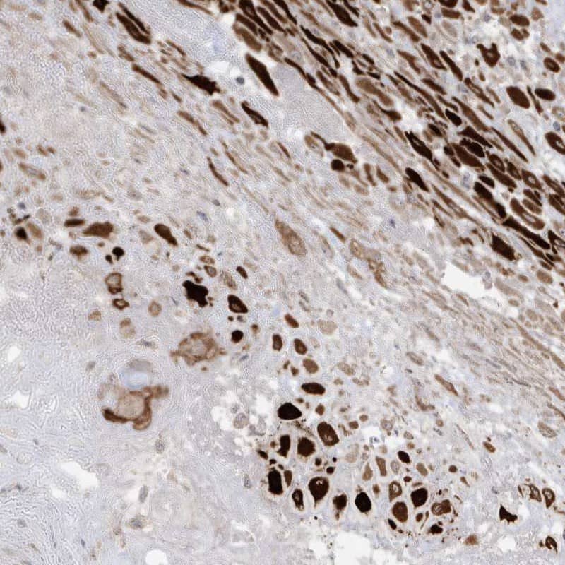 Immunohistochemistry-Paraffin RGL4 Antibody - BSA Free