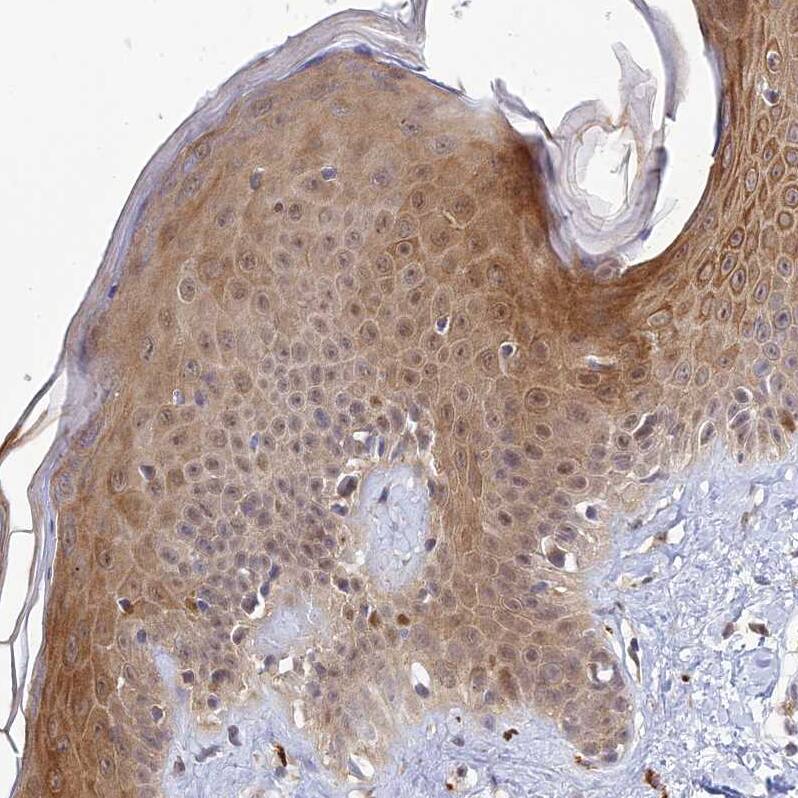 Staining of human skin shows moderate cytoplasmic positivity in squamous epithelial cells.