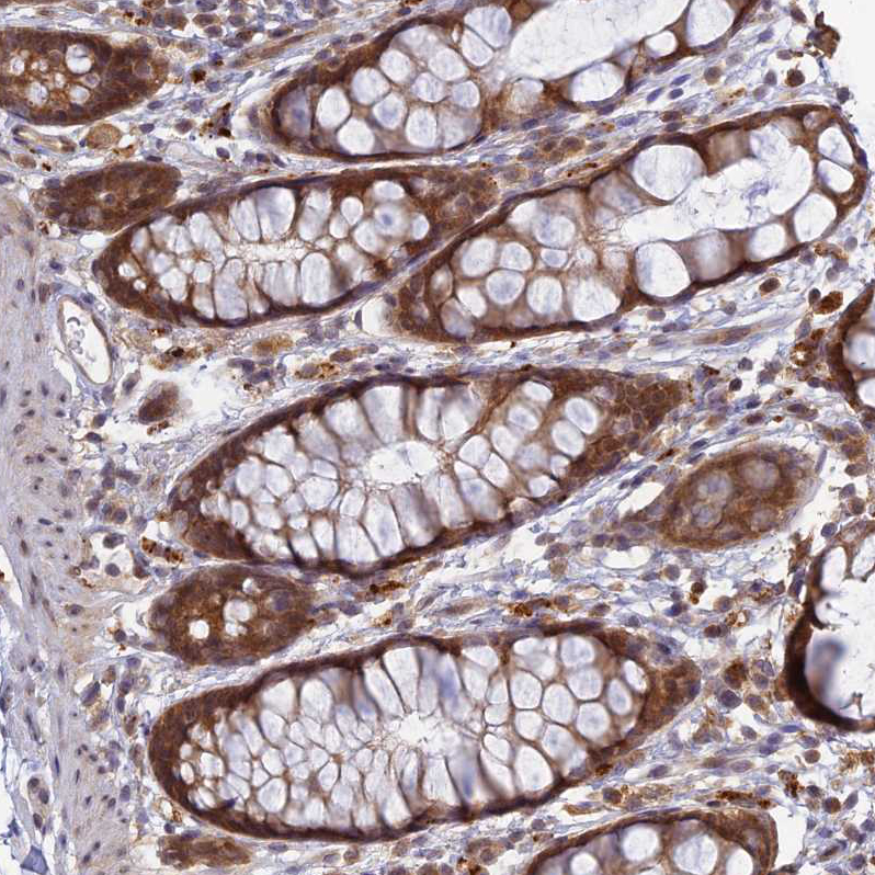 Staining of human rectum shows moderate cytoplasmic positivity in glandular cells.