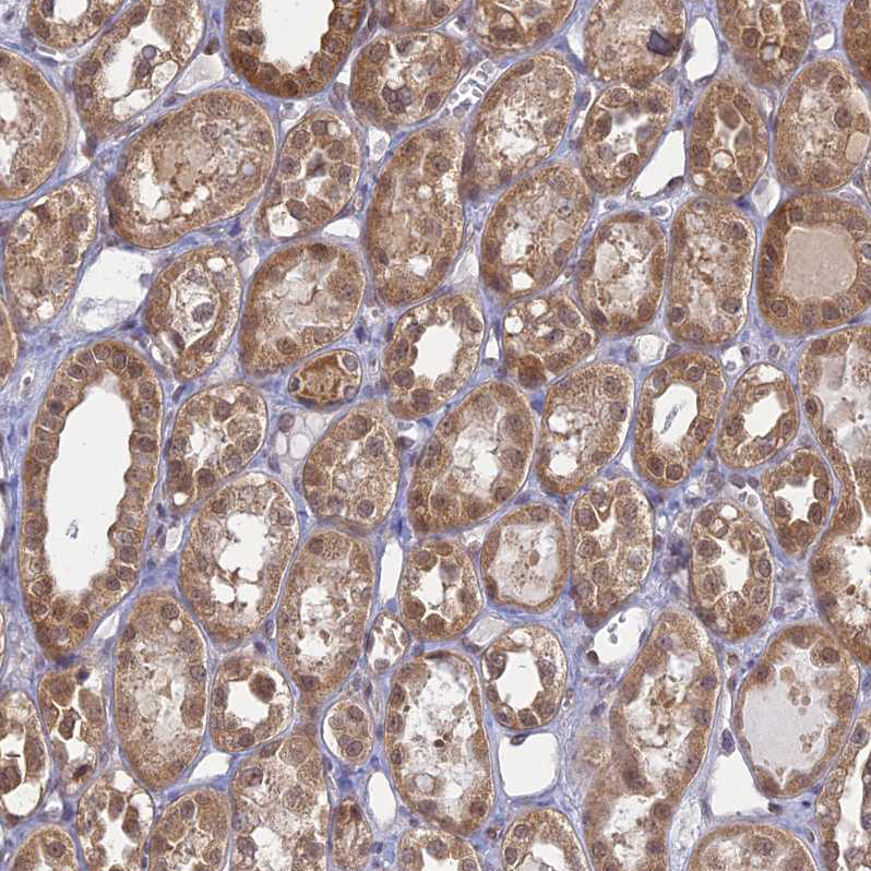 Staining of human kidney shows moderate cytoplasmic positivity in cells in tubules.