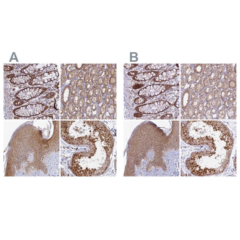 Staining of human gastrointestinal, kidney, skin and testis HPA040065 (A) shows similar protein distribution across tissues to independent antibody HPA039932 (B).