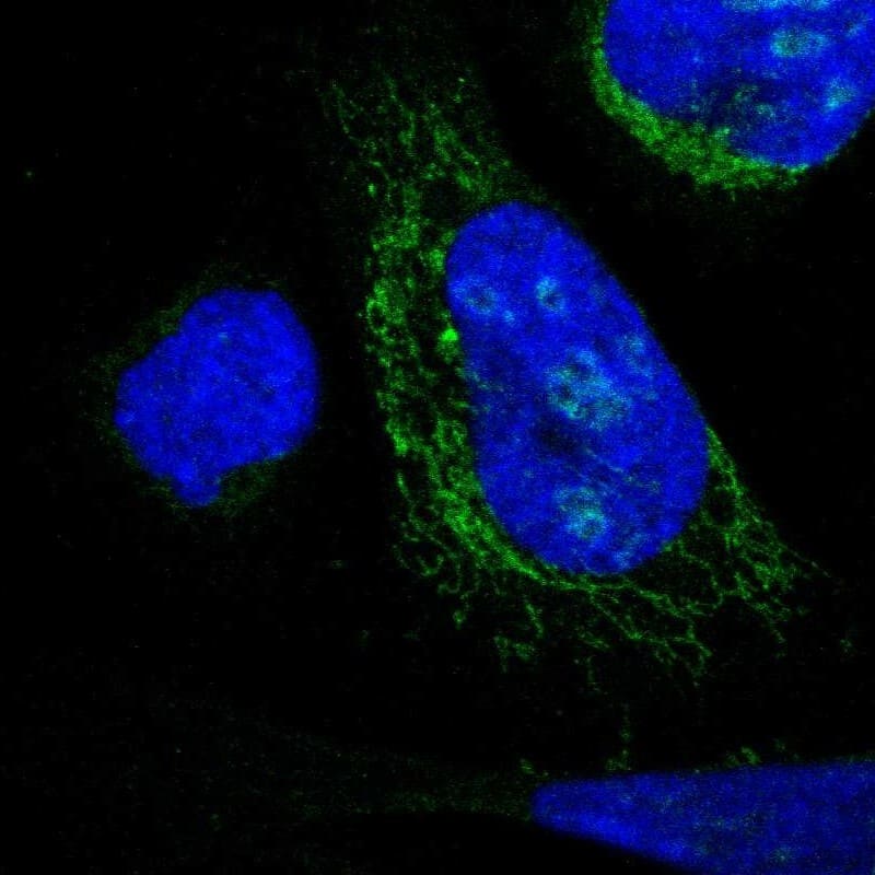Immunocytochemistry/ Immunofluorescence DHRS3 Antibody - BSA Free
