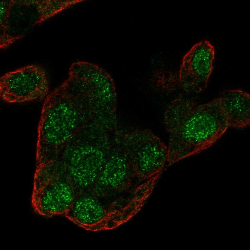 Staining of human cell line Hep G2 shows localization to nucleus.