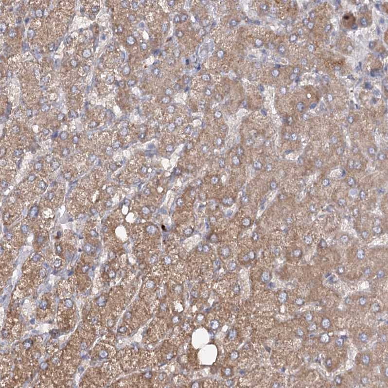 Immunohistochemistry-Paraffin RIN2 Antibody - BSA Free