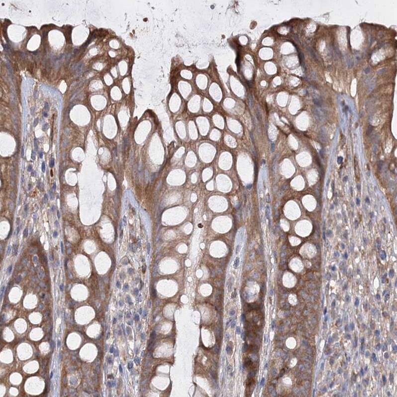 Staining of human rectum shows moderate cytoplasmic positivity in glandular cells.