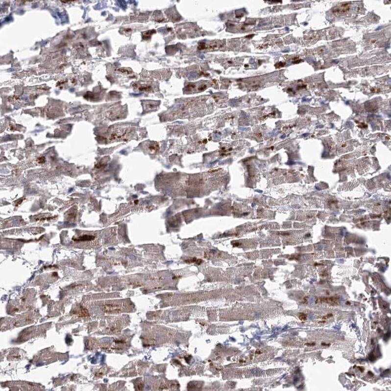 Staining of human heart muscle shows moderate cytoplasmic positivity in cardiomyocytes.
