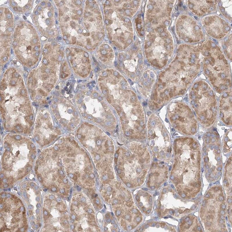 Staining of human kidney shows moderate cytoplasmic positivity in cells in tubules.