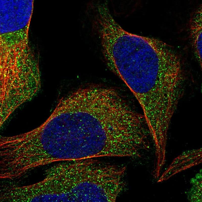 Staining of human cell line U-2 OS shows localization to vesicles.