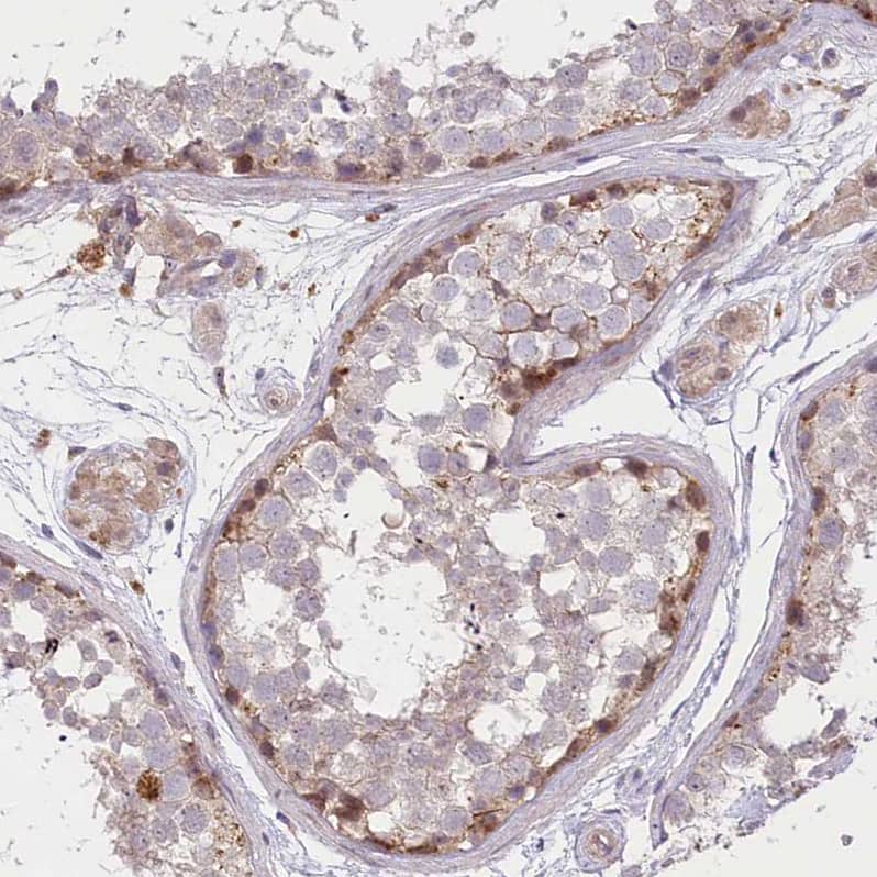 Immunohistochemistry-Paraffin TRUB1 Antibody - BSA Free