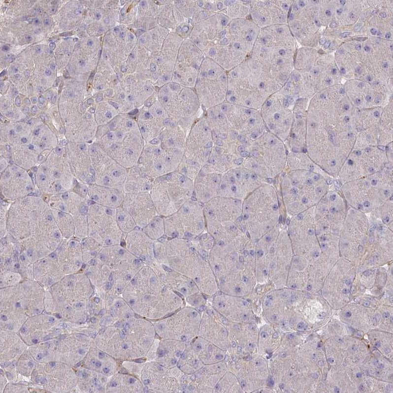 Staining of human pancreas shows no positivity in exocrine glandular cells as expected.