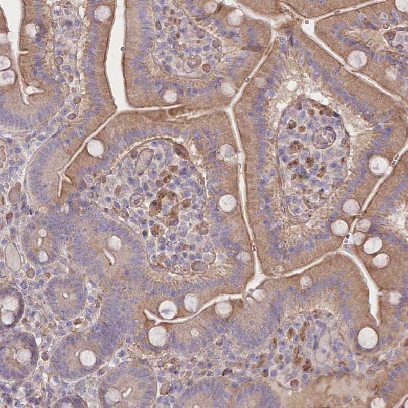 Staining of human duodenum shows moderate cytoplasmic positivity in glandular cells.