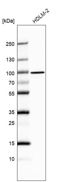Analysis in human cell line HDLM-2.