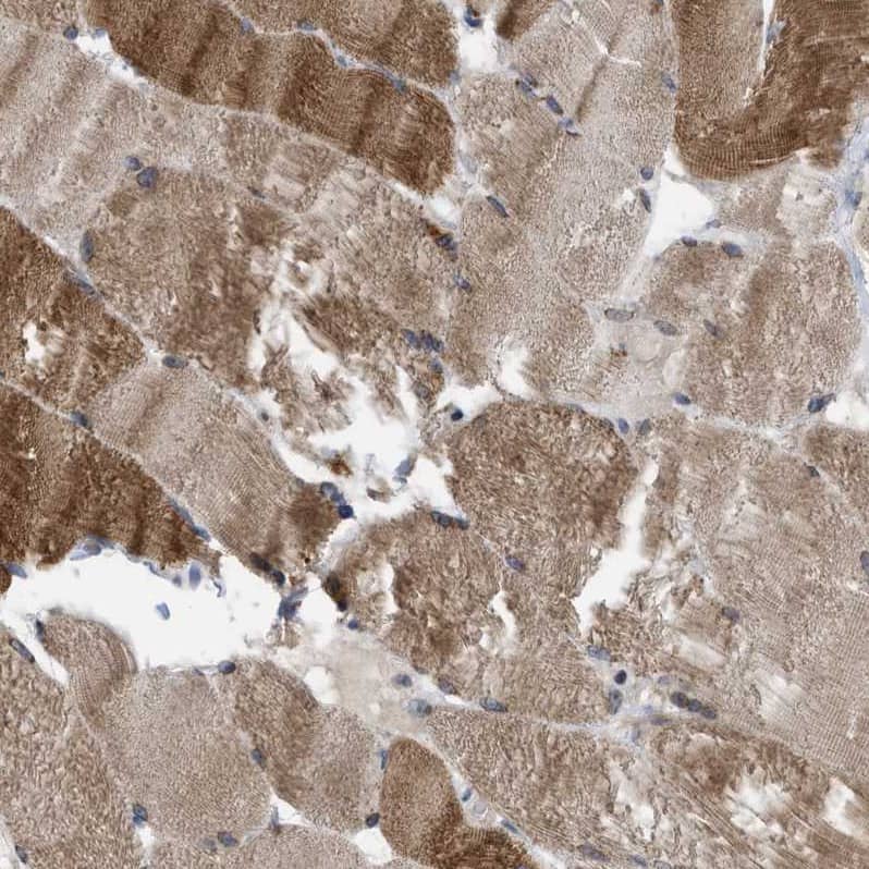 Immunohistochemistry-Paraffin TMEM159 Antibody - BSA Free