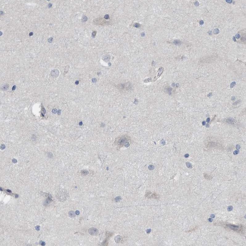 Immunohistochemistry-Paraffin TMEM159 Antibody - BSA Free