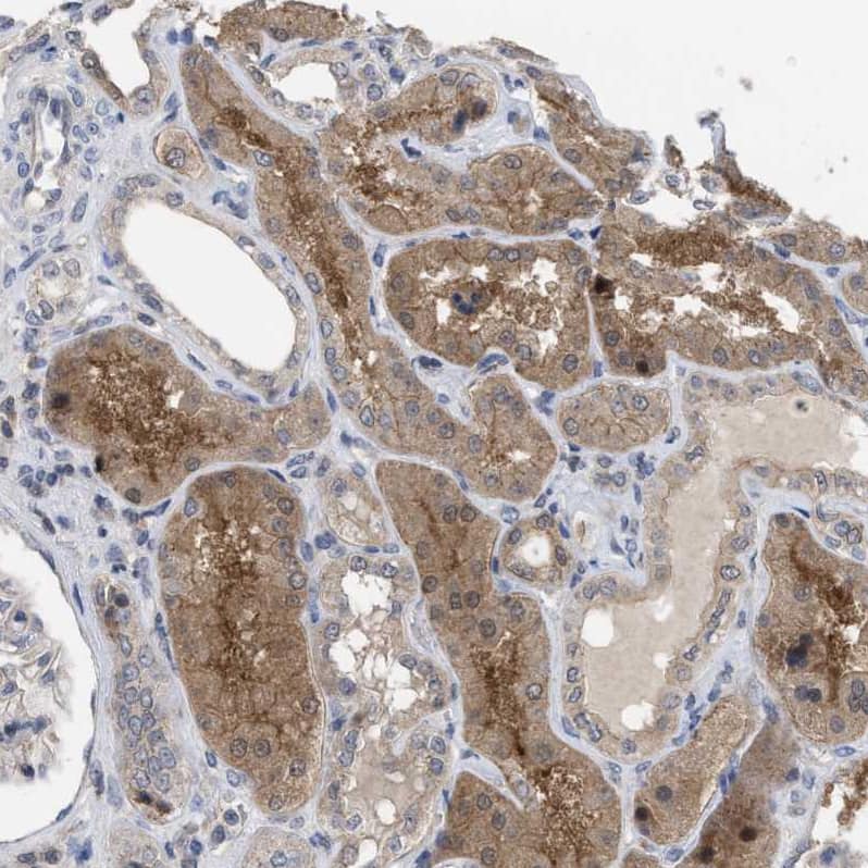 Immunohistochemistry-Paraffin TMEM159 Antibody - BSA Free