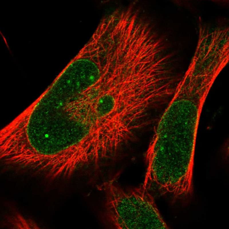 Staining of human cell line U-251 MG shows localization to nucleoli fibrillar center & nuclear membrane.