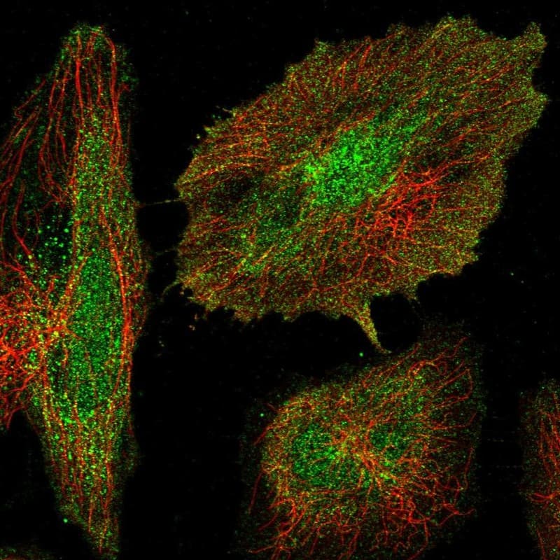 Immunocytochemistry/ Immunofluorescence AVPI1 Antibody - BSA Free