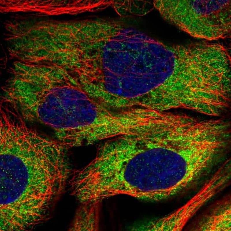 Staining of human cell line A-431 shows localization to cytosol.