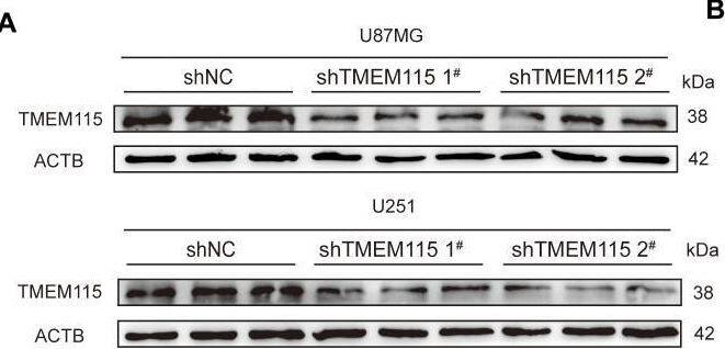 High expression TMEM115 accelerated malignant phenotype of glioma cells. (A, B) Knockdown of TMEM115 in U87MG and U251 glioma cells and validation of knockdown efficiency. (C, D) Cell proliferation after knockdown of TMEM115 was assessed by CCK-8 assay. (E-J) The ability to migrate and invade was measured using the Transwell assay after knocking down TMEM115. *P < 0.05, **P < 0.01, ****P < 0.0001, Scale bar = 50 μm. Image collected and cropped by CiteAb from the following open publication (//pubmed.ncbi.nlm.nih.gov/40552281), licensed under a CC-BY license. Not internally tested by Novus Biologicals.