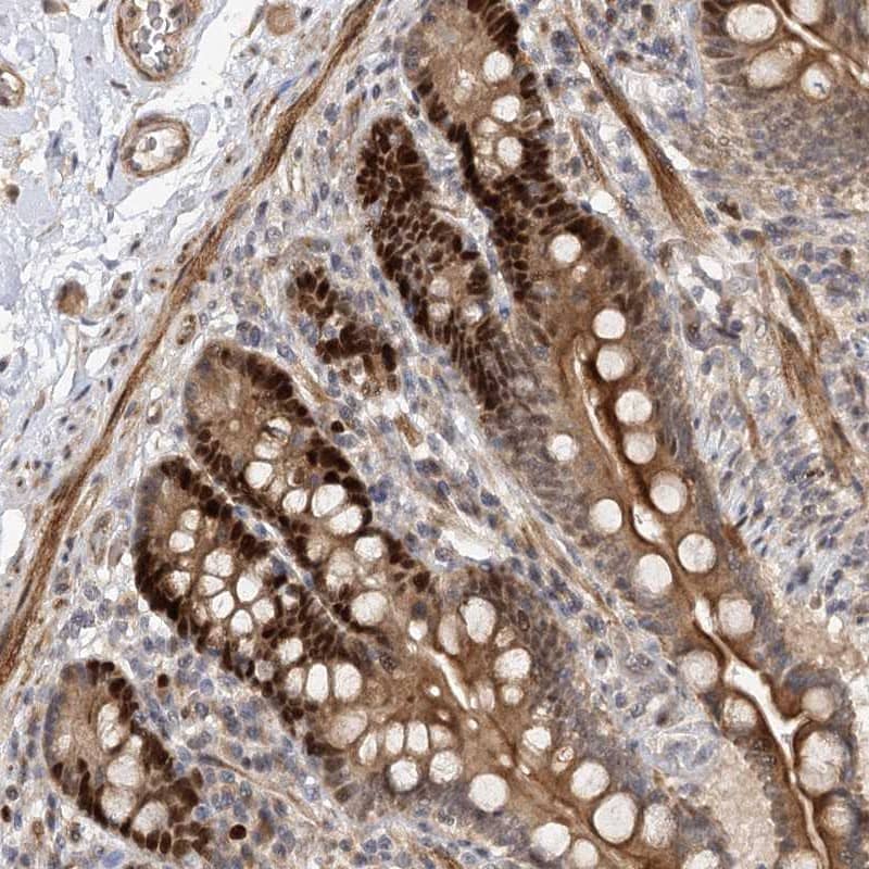 Staining of human colon shows strong nuclear and cytoplasmic positivity in glandular cells.