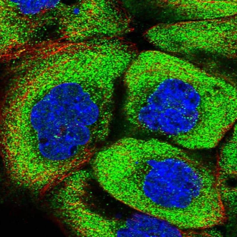 Staining of human cell line A-431 shows localization to cytosol.