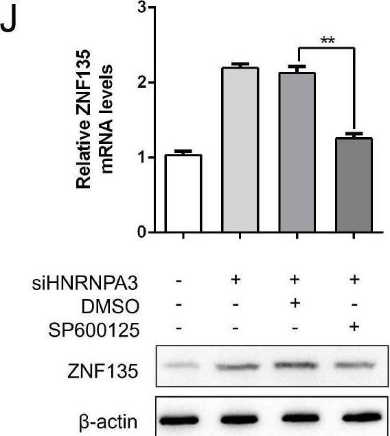 Western Blot ZNF135 Antibody - BSA Free