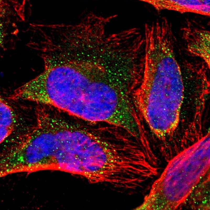 Staining of human cell line U-2 OS shows localization to vesicles.
