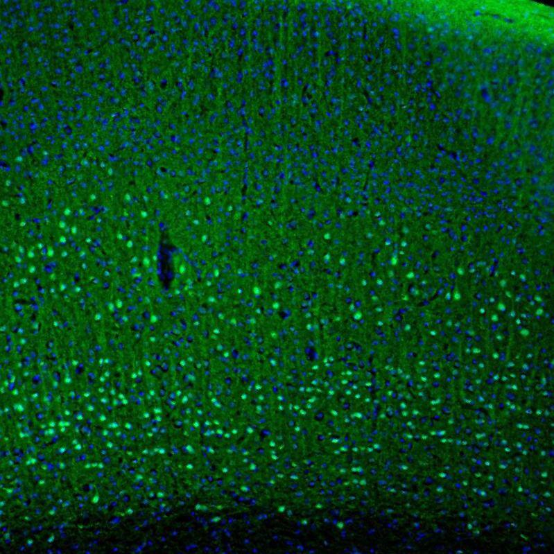 Immunohistochemistry-Paraffin PCP4 Antibody - BSA Free
