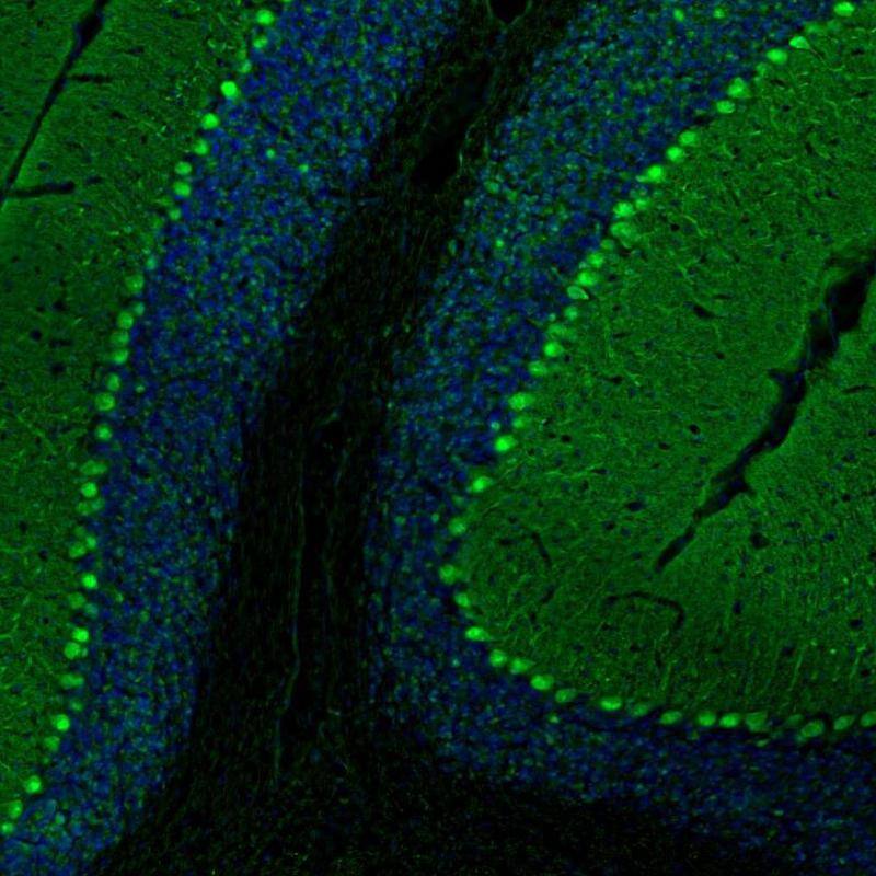 Immunohistochemistry-Paraffin PCP4 Antibody - BSA Free