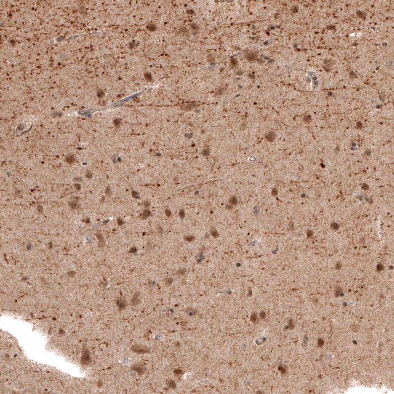 Staining of human cerebral cortex shows moderate cytoplasmic positivity.