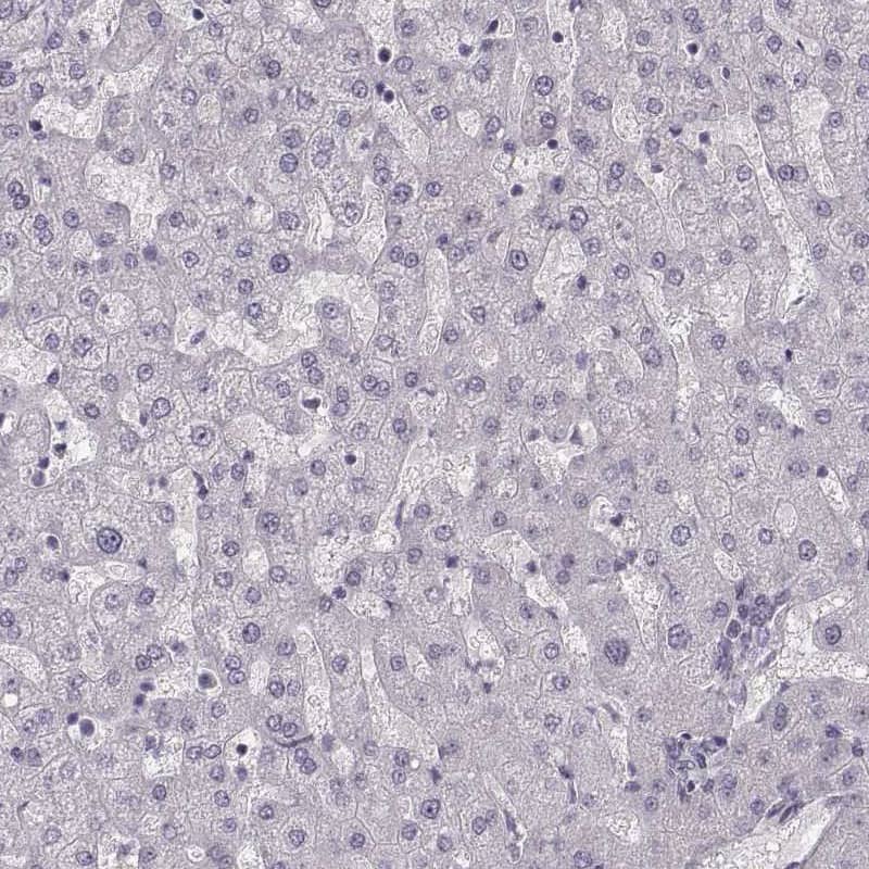 Staining of human liver shows no cytoplasmic positivity in hepatocytes as expected.