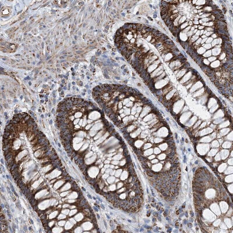 Staining of human rectum shows strong granular cytoplasmic positivity in glandular cells.