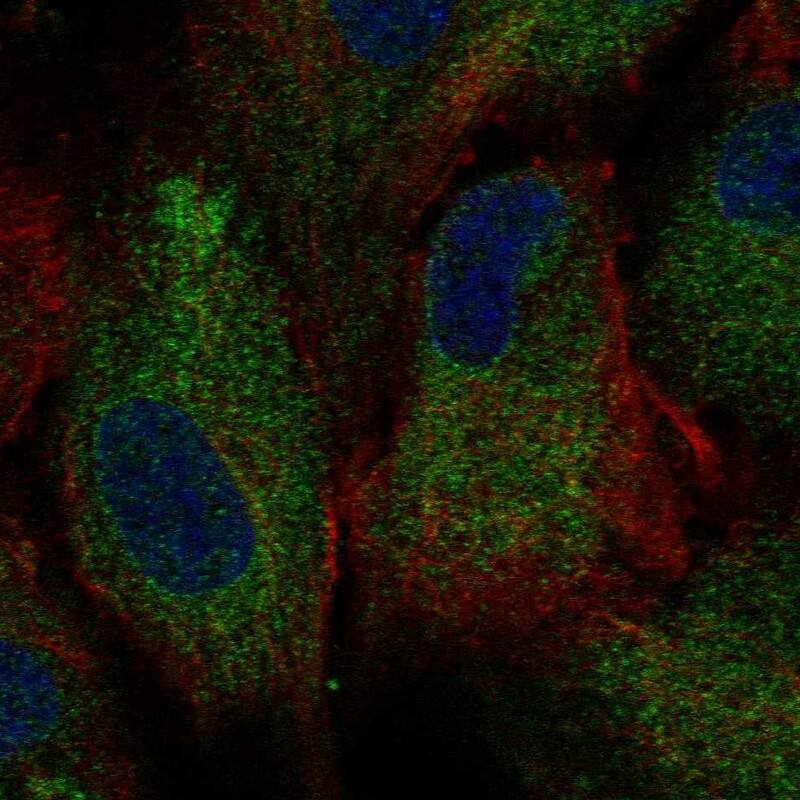 Immunocytochemistry/ Immunofluorescence Polycystin 2 Antibody - BSA Free
