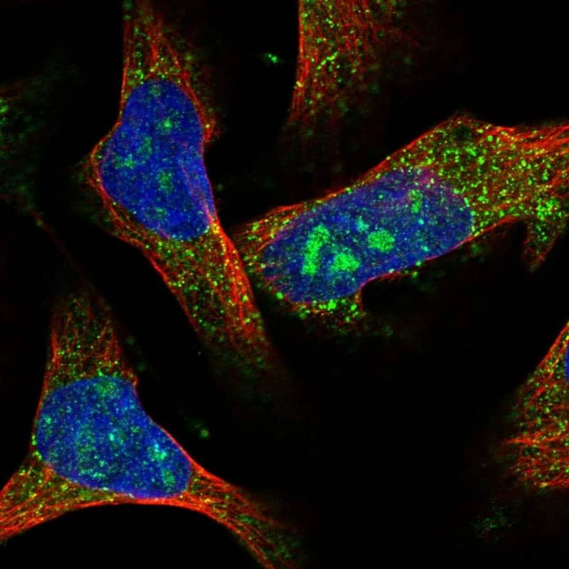 Immunocytochemistry/ Immunofluorescence ACOX1 Antibody - BSA Free