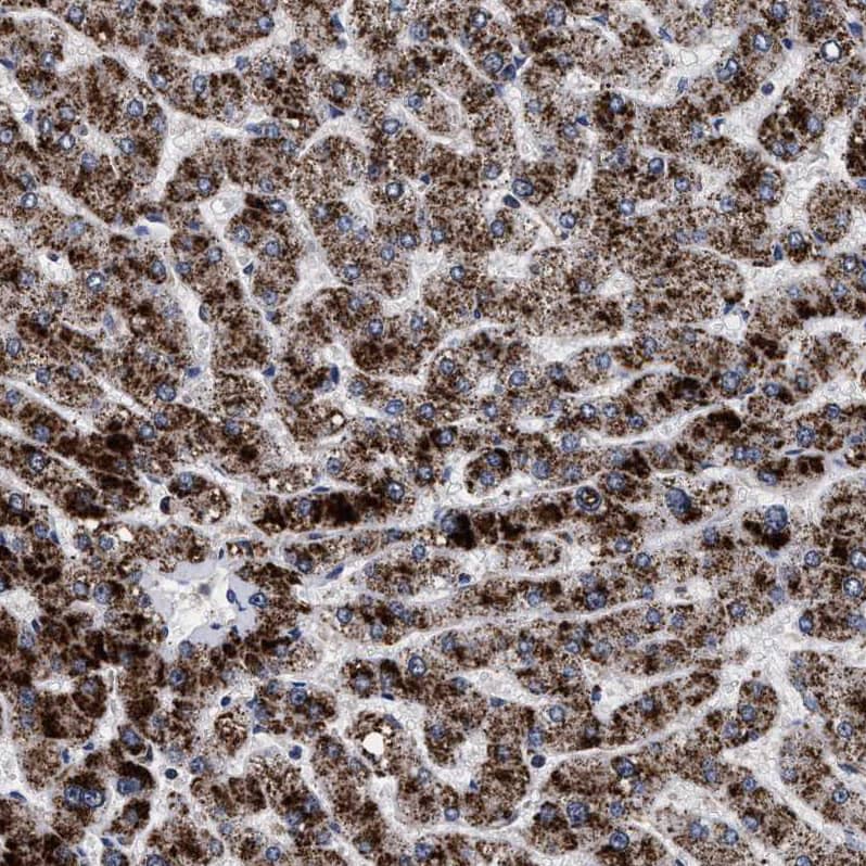 Immunohistochemistry-Paraffin ACOX1 Antibody - BSA Free