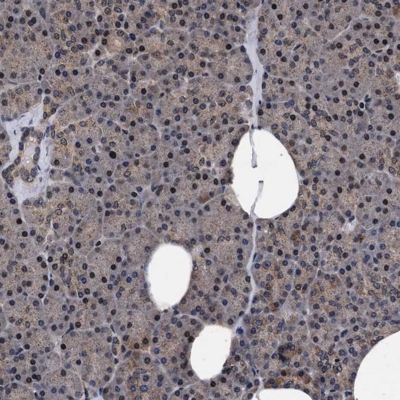 Immunohistochemistry-Paraffin ACOX1 Antibody - BSA Free