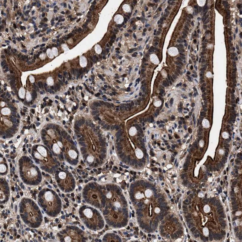 Immunohistochemistry-Paraffin ACOX1 Antibody - BSA Free