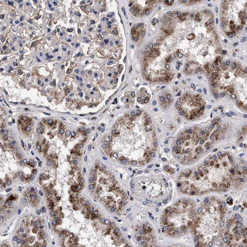 Immunohistochemistry-Paraffin ACOX1 Antibody - BSA Free