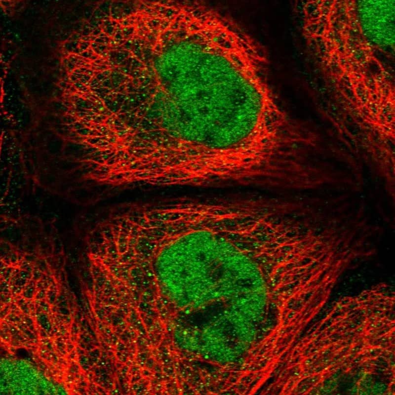 Immunocytochemistry/ Immunofluorescence REXO1 Antibody