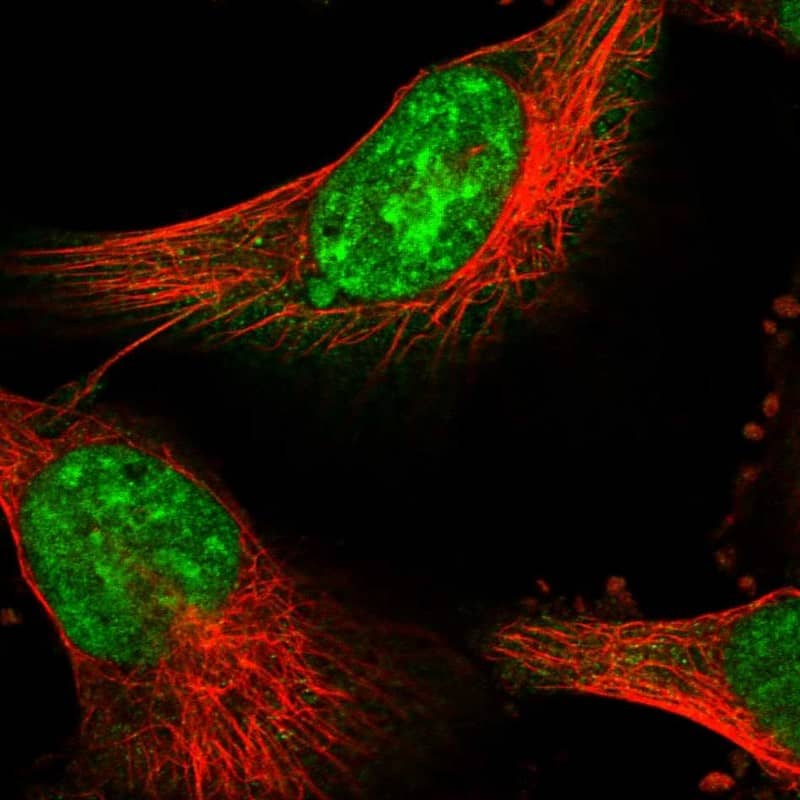 Staining of human cell line U-251 MG shows localization to nucleoli & nuclear speckles.