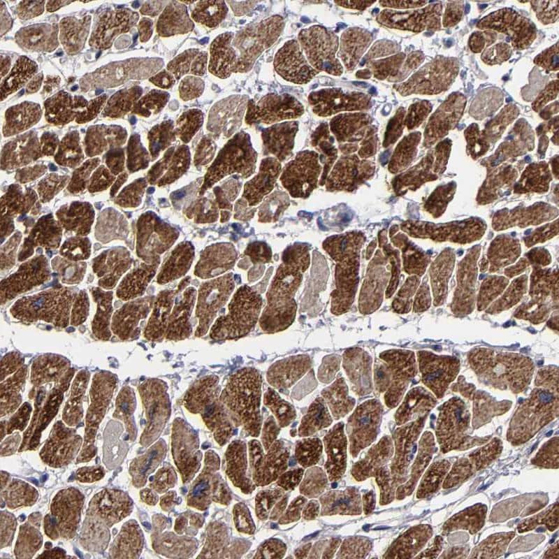 Immunohistochemistry-Paraffin ZNF175 Antibody - BSA Free