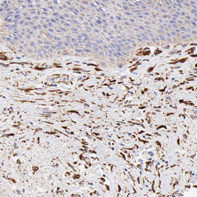 Staining of human skin shows moderate cytoplasmic positivity in fibroblasts.