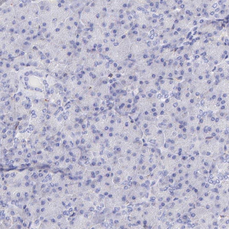 Staining of human pancreas shows no positivity in exocrine glandular cells as expected.