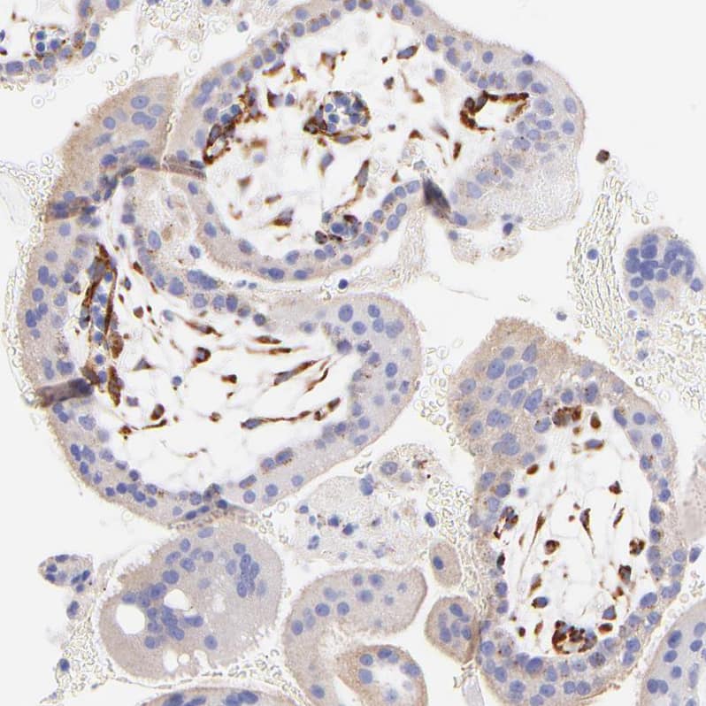 Staining of human placenta shows moderate cytoplasmic positivity in fibroblasts.