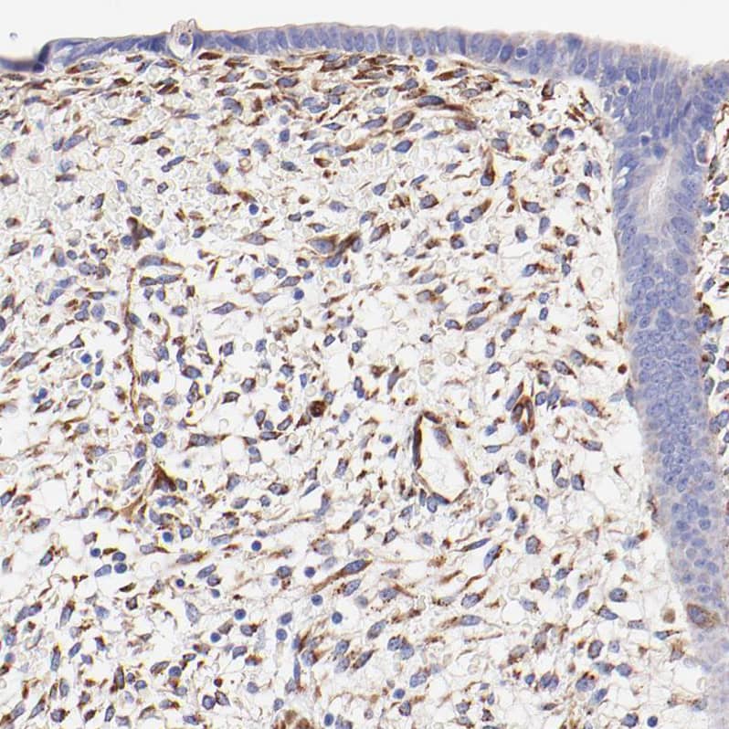 Staining of human endometrium shows moderate cytoplasmic positivity in stromal cells.