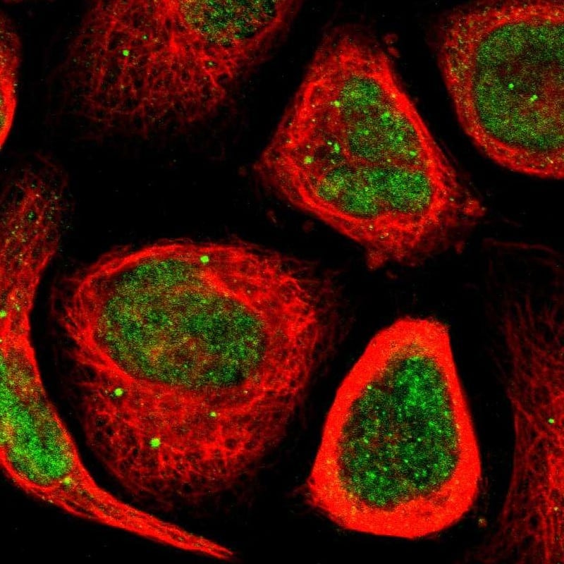 Immunocytochemistry/ Immunofluorescence MYEOV Antibody - BSA Free