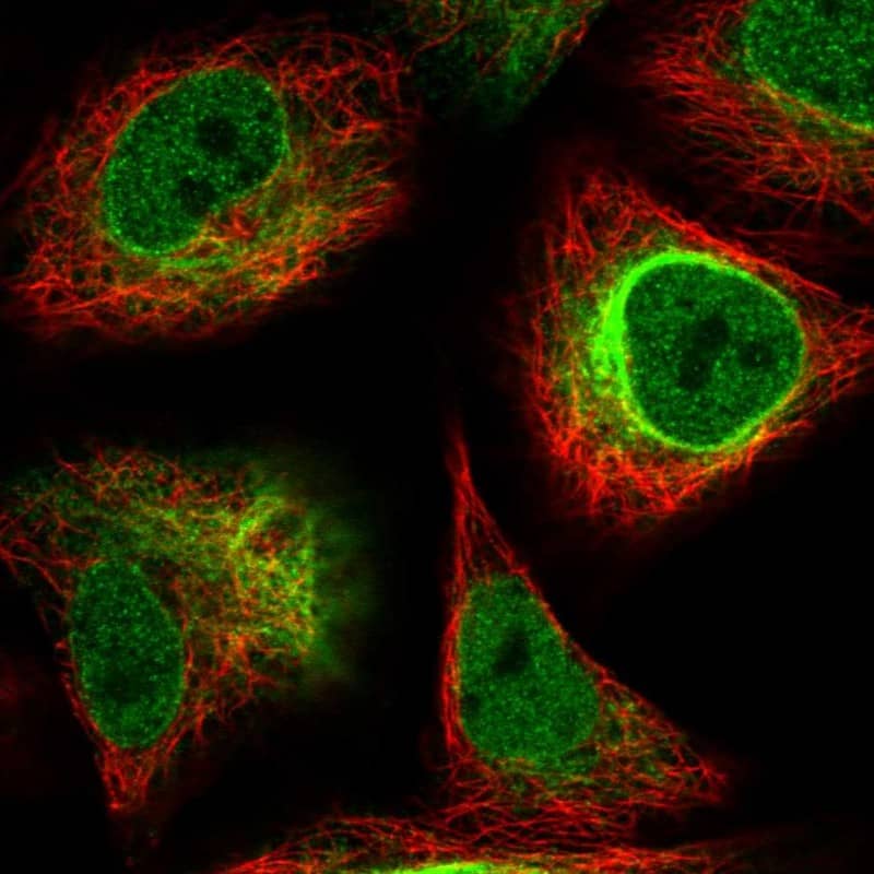 Staining of human cell line A549 shows localization to nucleoplasm, nuclear membrane & intermediate filaments.