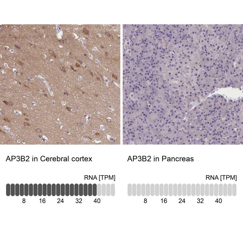 <b>Orthogonal Strategies Validation. </b>Analysis in human cerebral cortex and pancreas tissues.